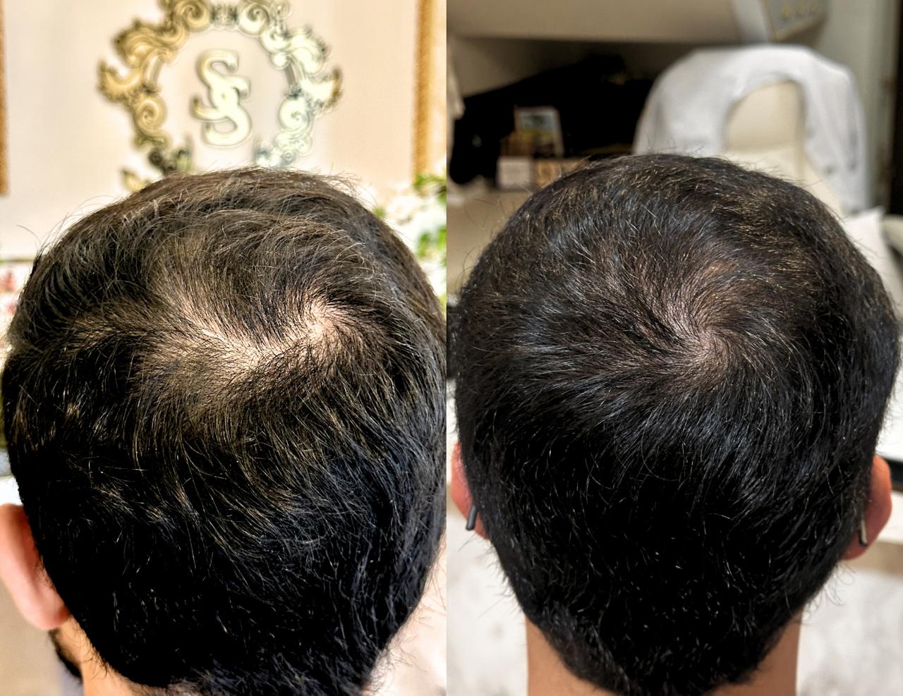 ExoHair